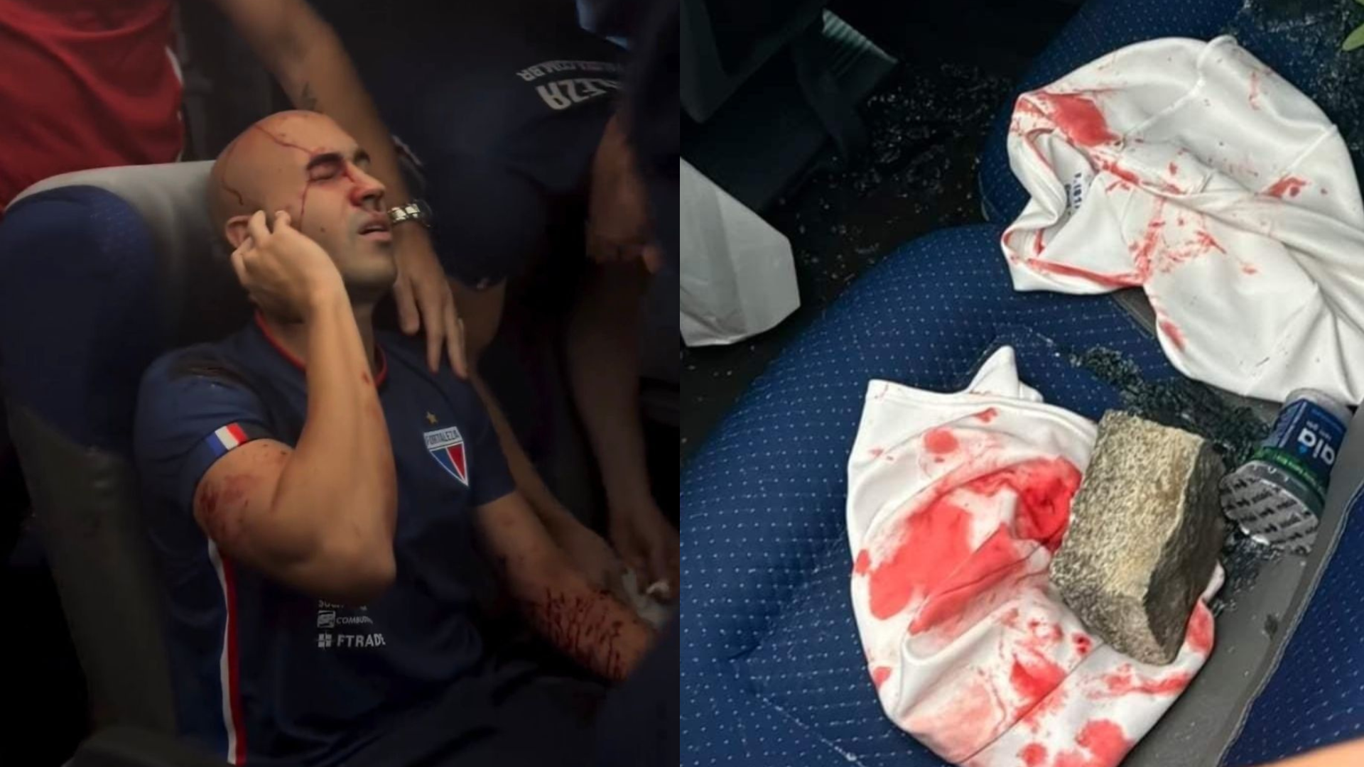 O confronto entre o Fortaleza EC e o Sport pela Copa do Nordeste terminou em um atentado violento